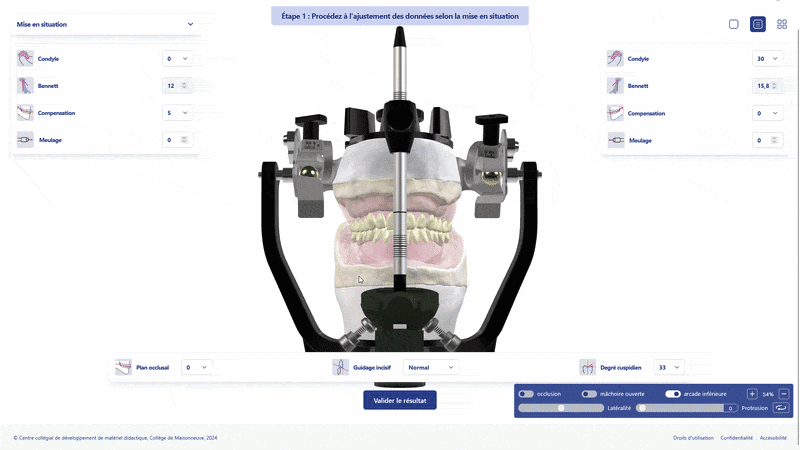 Démonstration animée du simulateur SI-MON : manipulation et réglage de l’articulateur Hanau en 3D