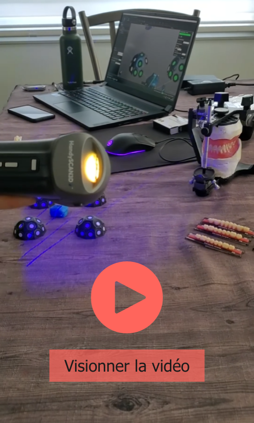 Numérisation 3D du matériel dentaire — visionner la vidéo